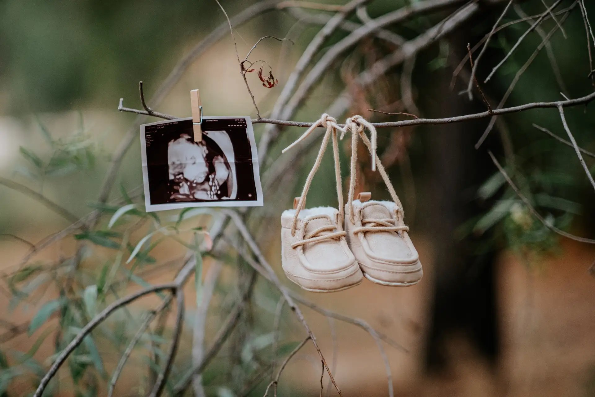 צילומי הריון