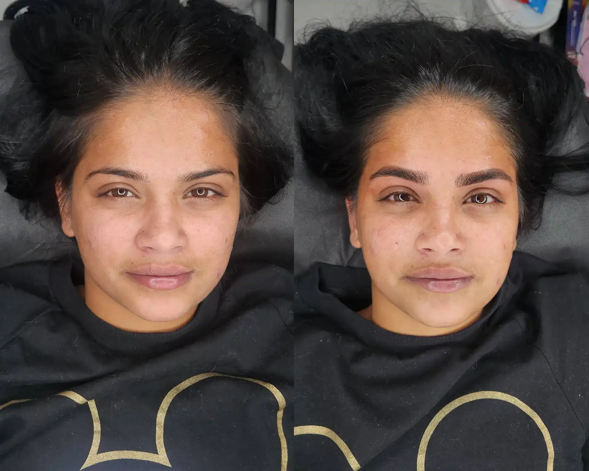 טיפול משולב