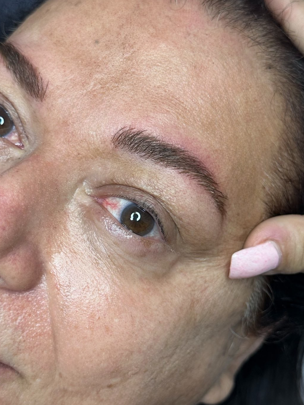 מיקרובליידינג