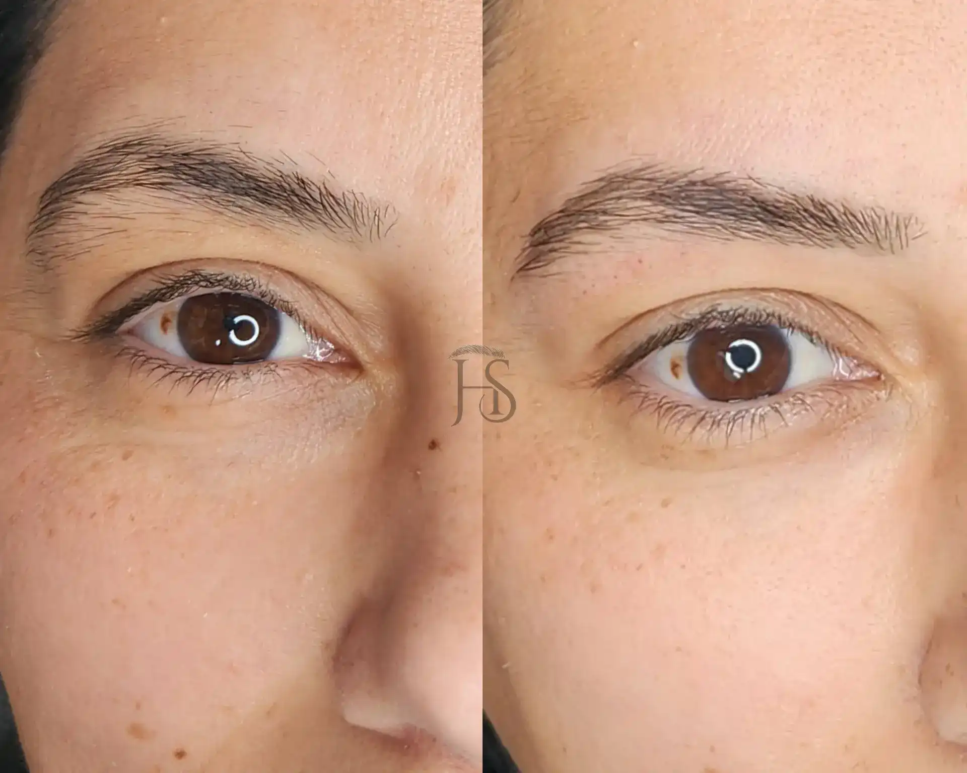 עיצוב ושיקום הגבות