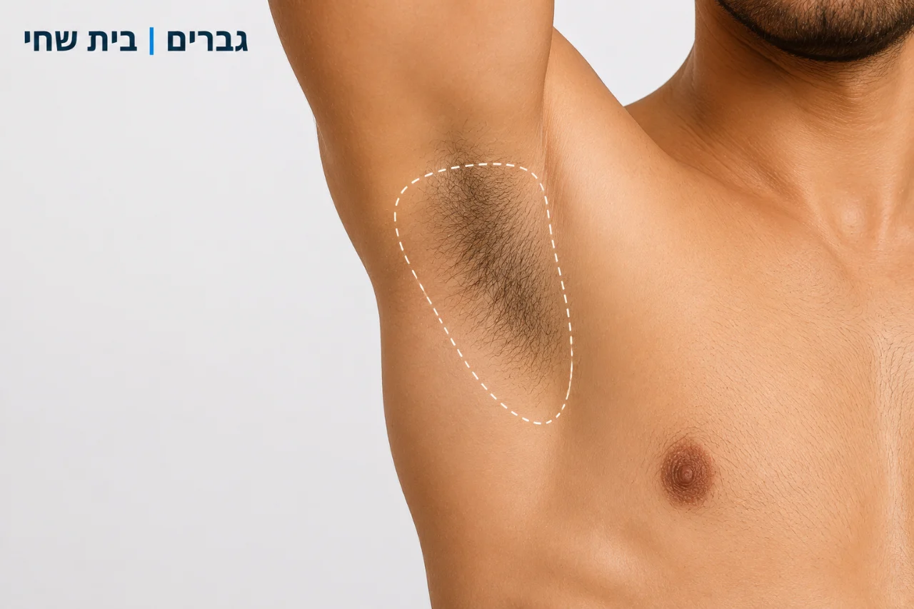 הסרת שיער בית שחי 10 טיפולים