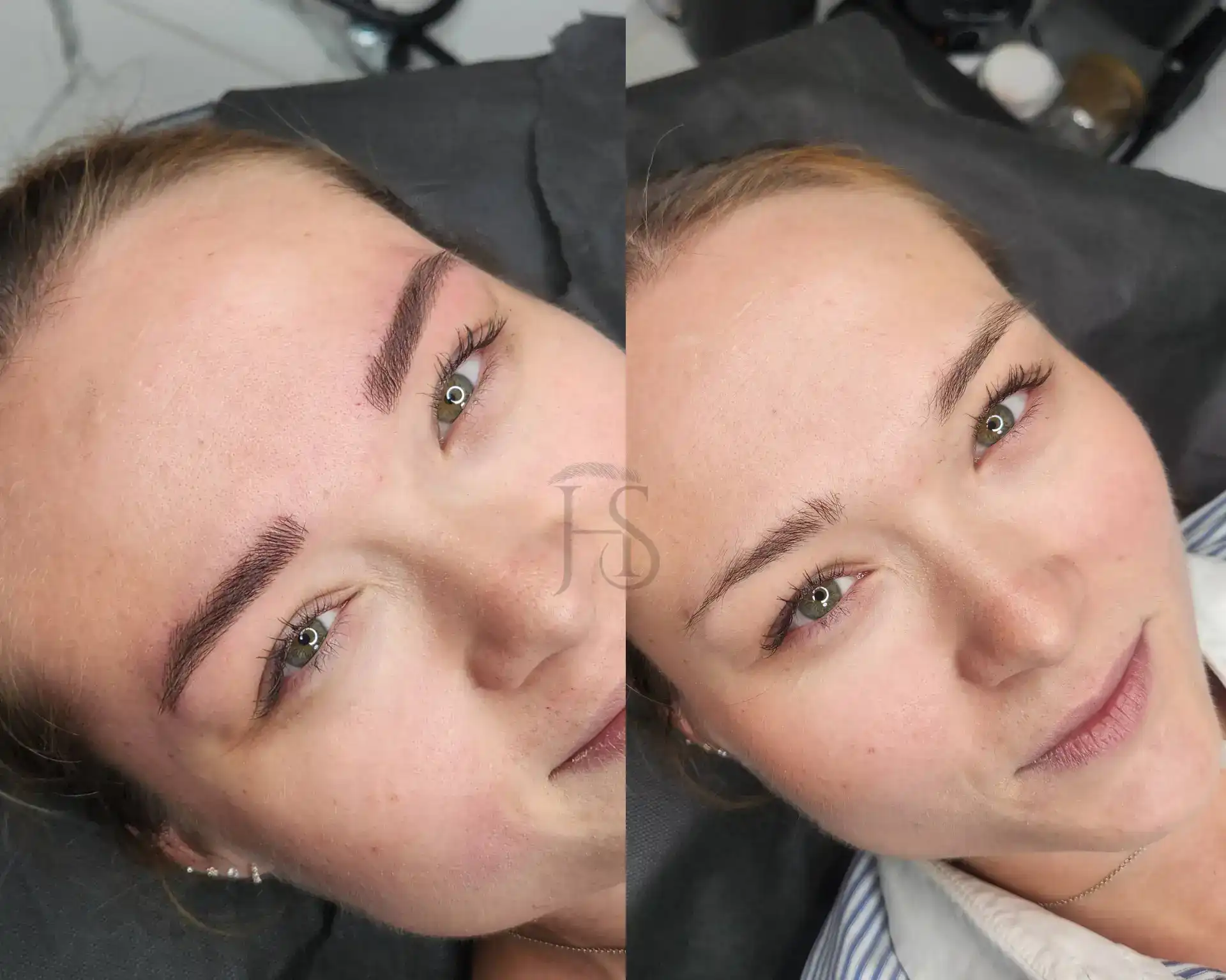 מיקרובליידינג