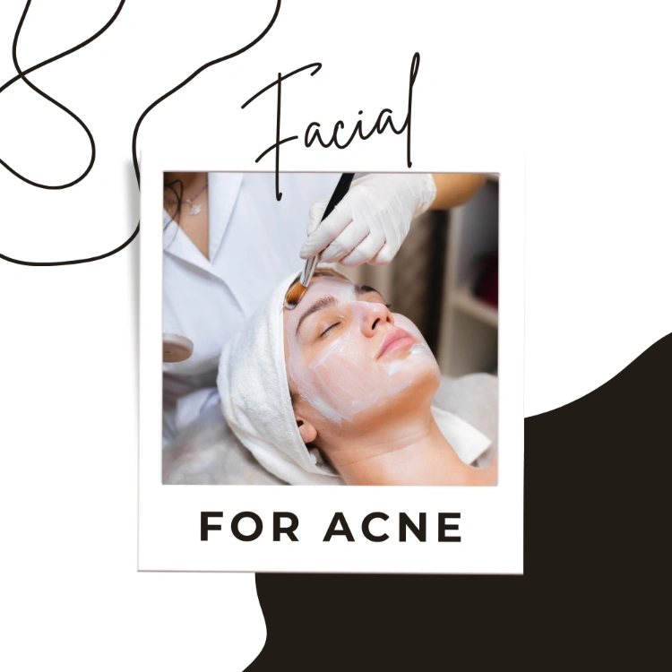 טיפולי אקנה