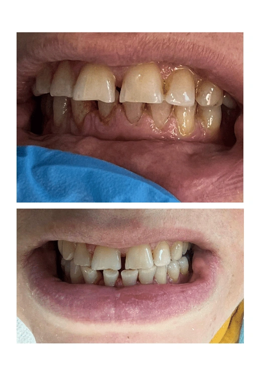 הלבנה ביתית