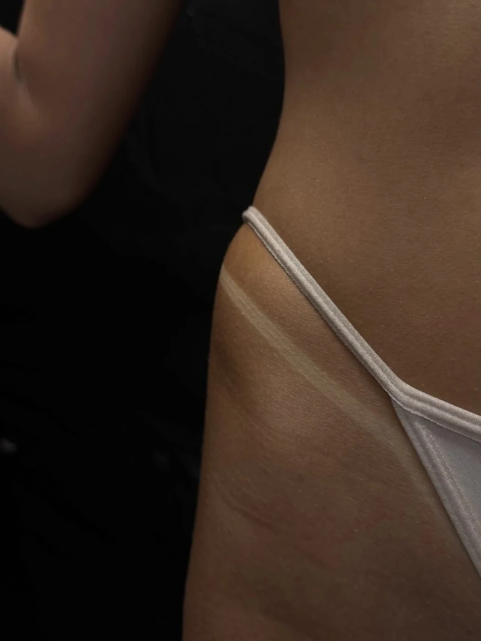 שיזוף בהתזה