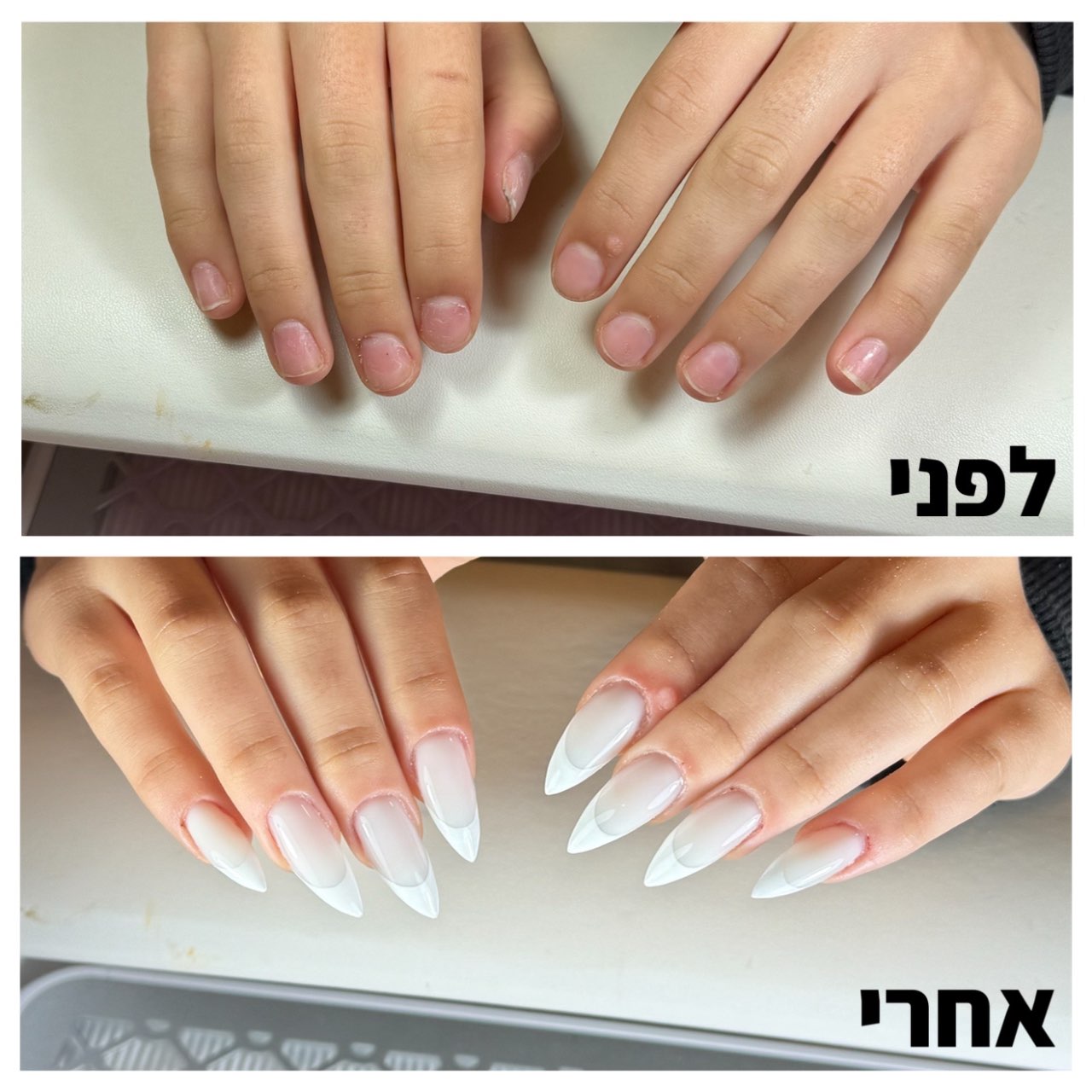 שיקום הציפורניים