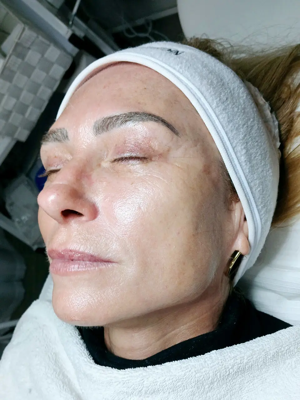 החדרת לחות באלקטרופורציה