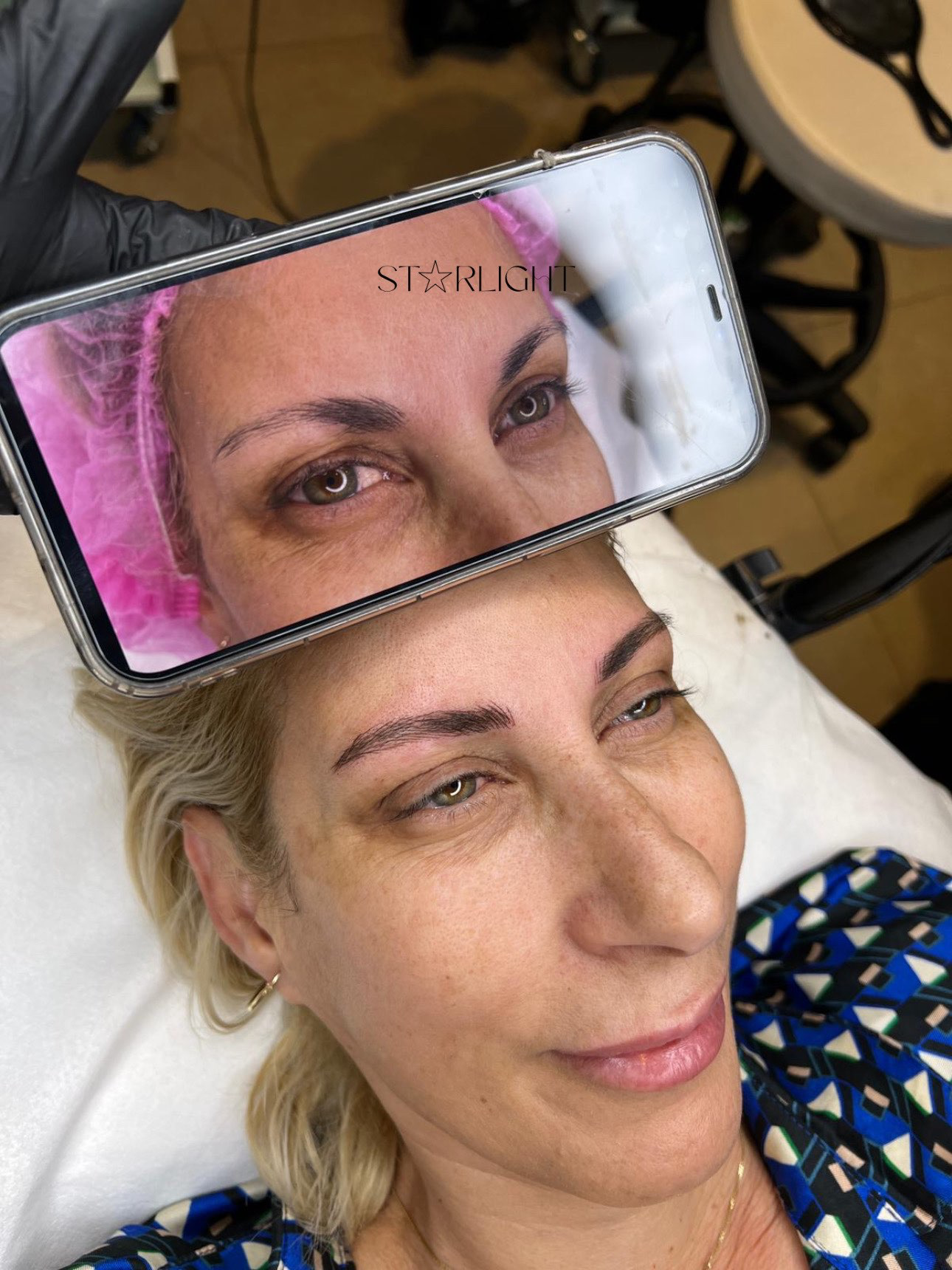 מיקרובליידינג