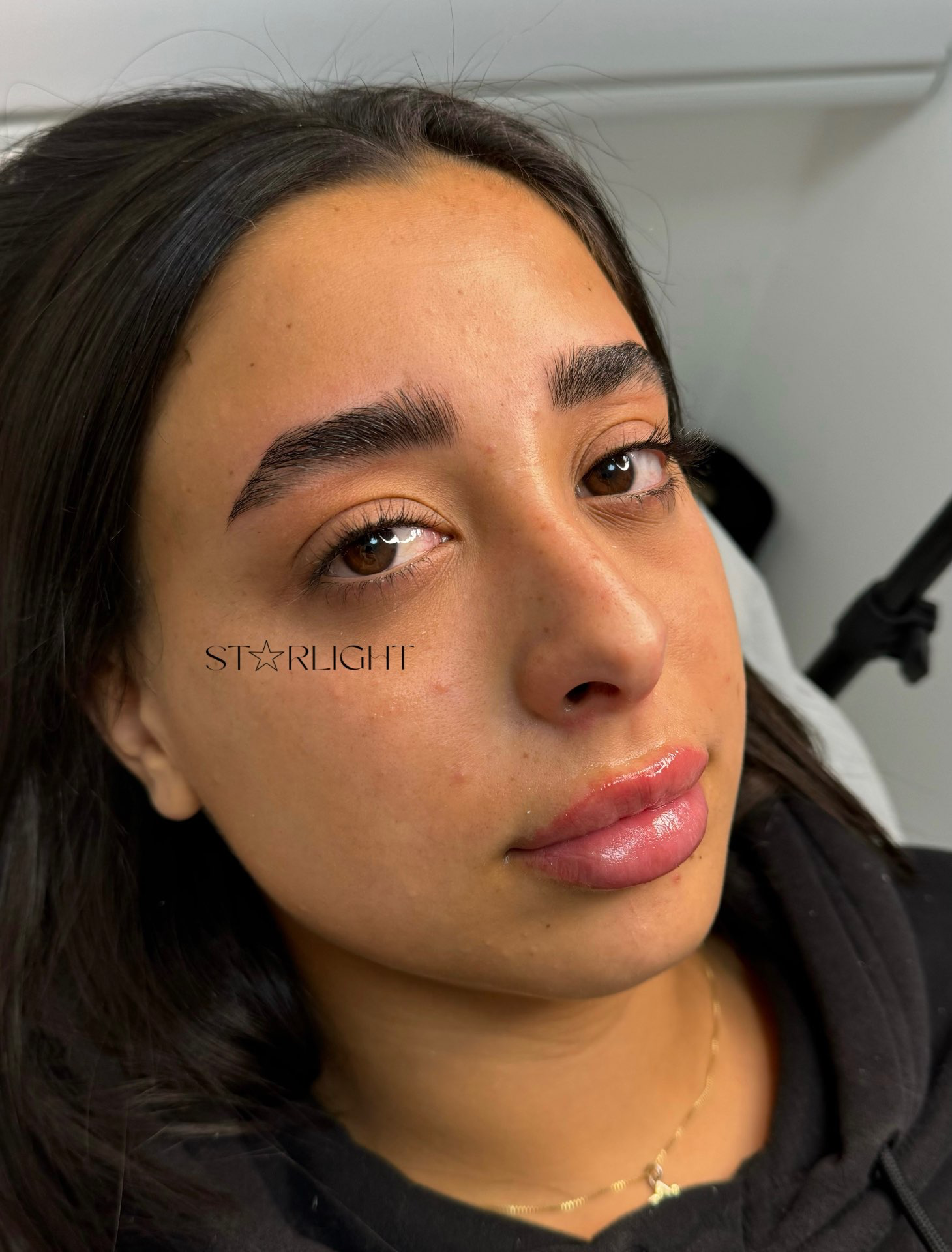 מיקרובליידינג