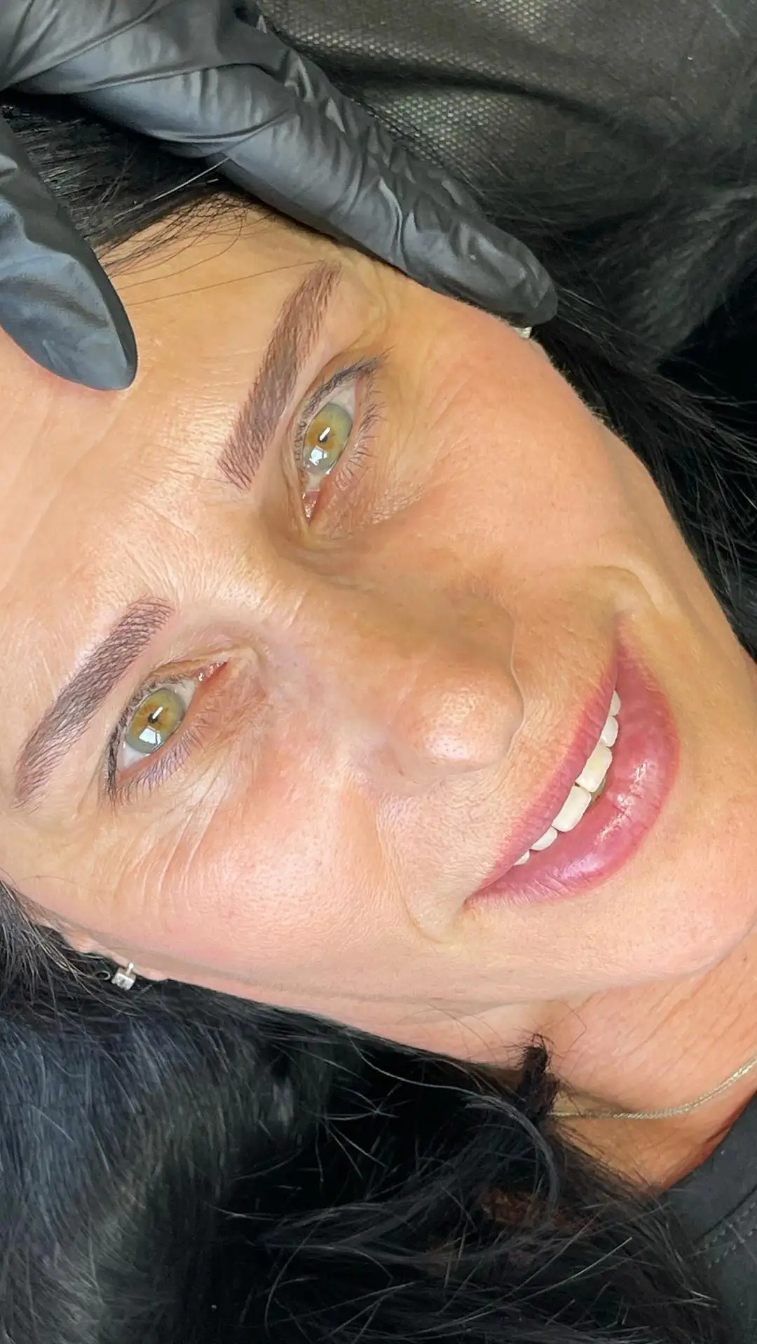 טיפול מיקרובליידינג בטכניקה טבעית