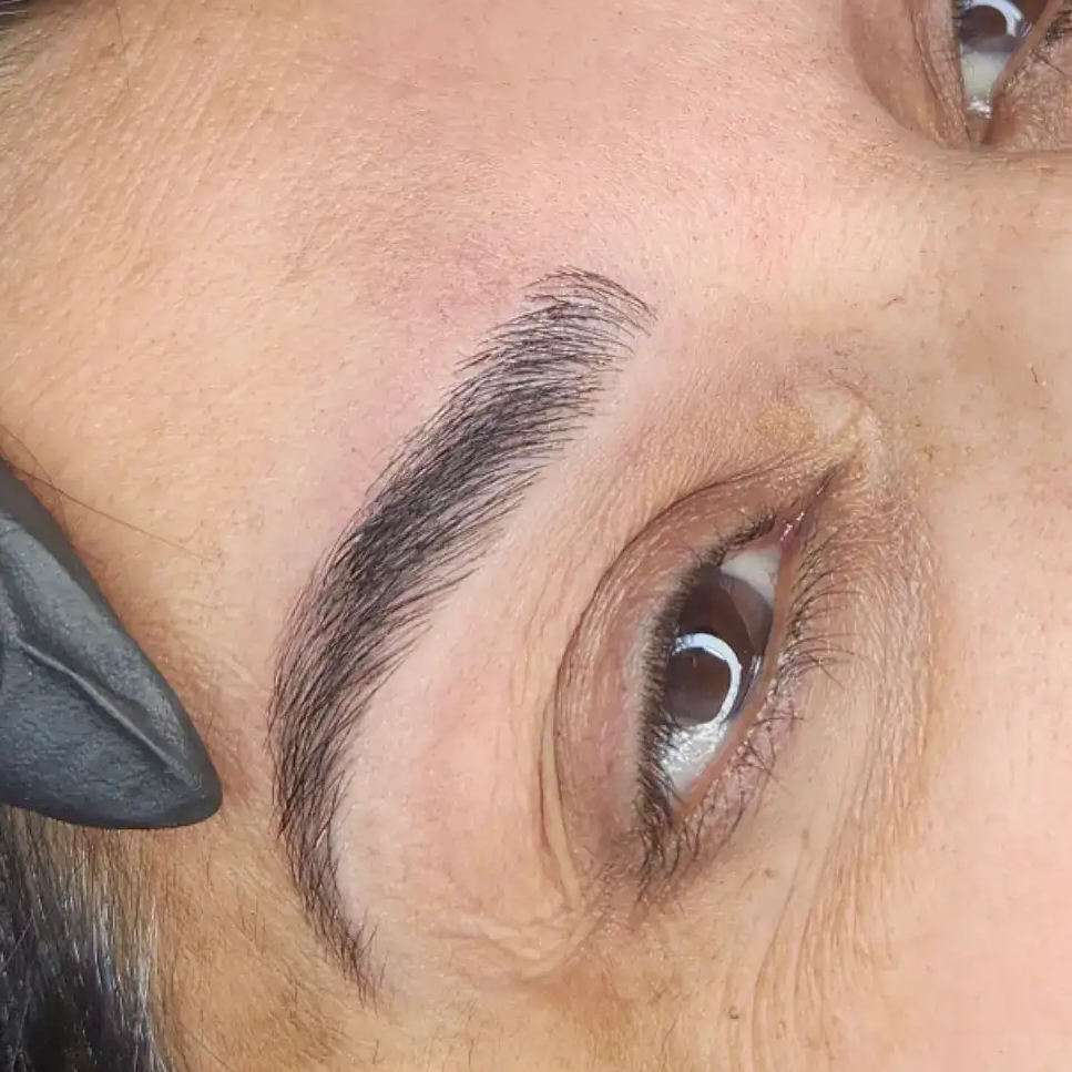 מיקרובליידינג