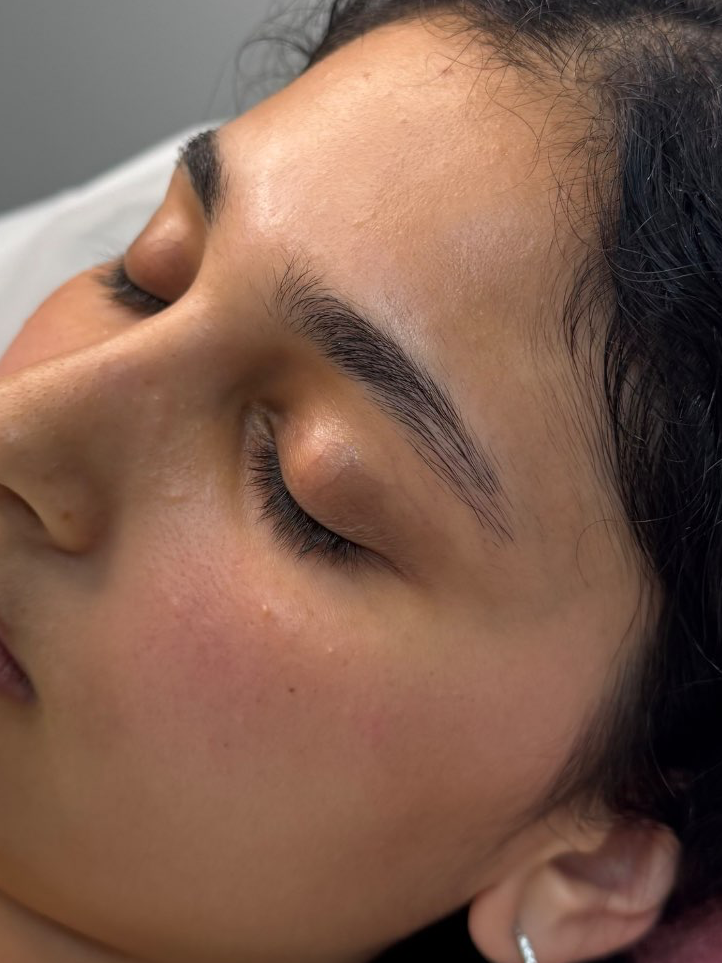 לפני - אחריי 🪄