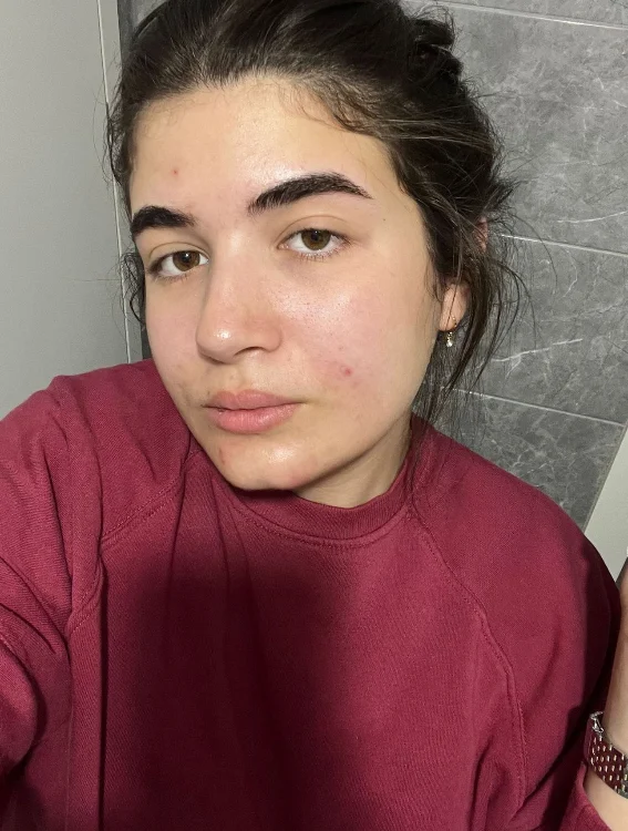 חבילת אקנה בייסיק