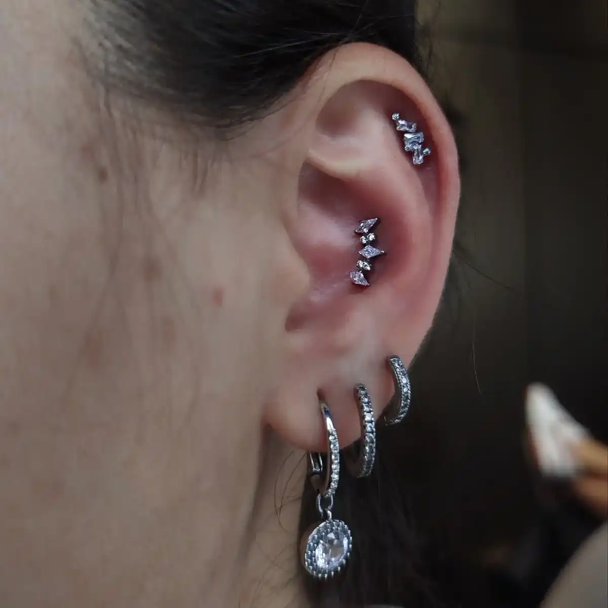  קונצ' והליקס