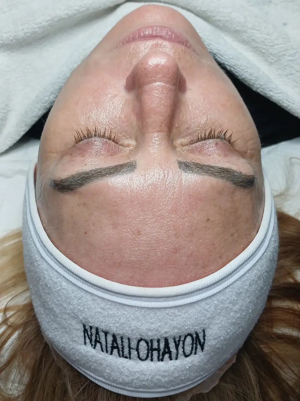 החדרת לחות באלקטרופורציה