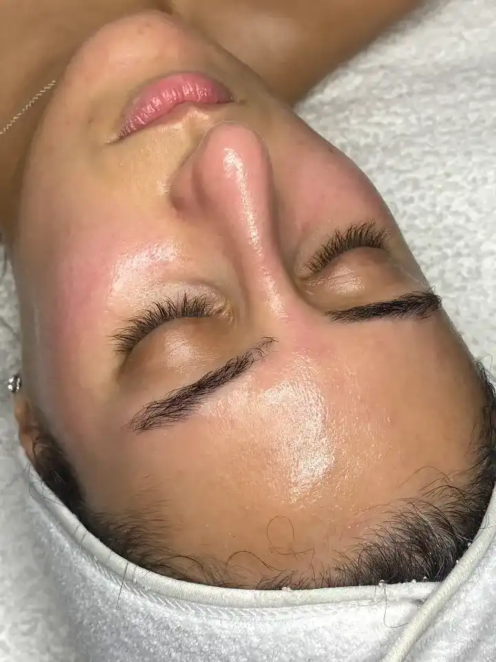 טיפול פנים קלאסי ביקנעם עילית | פיניש קוסמטיקס