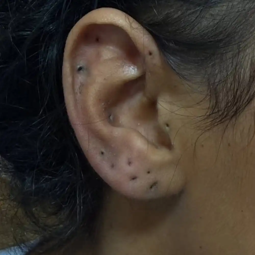 שירותי פירסינג כולל החלפה, עיצוב והסרה לפני בדיקה רפואית