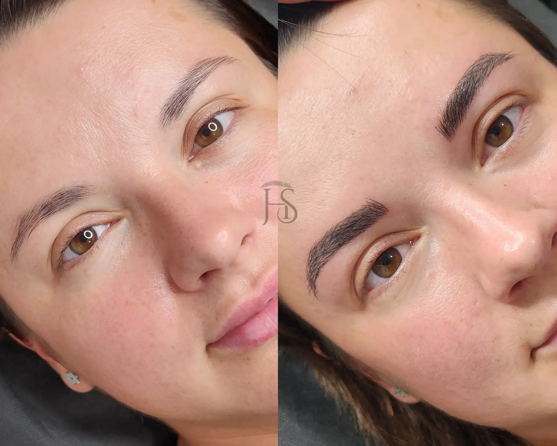 מיקרובליידינג