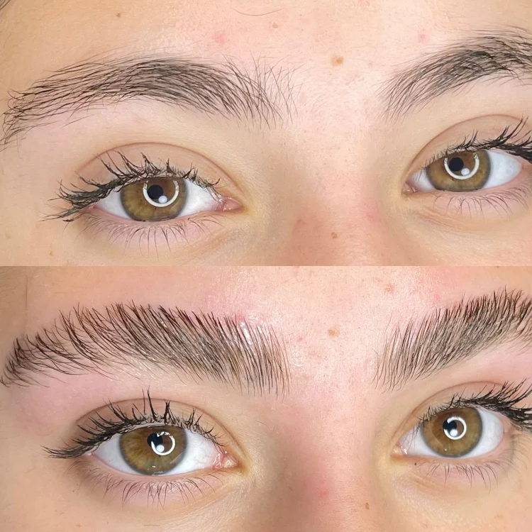 עיצוב ושיקום הגבות