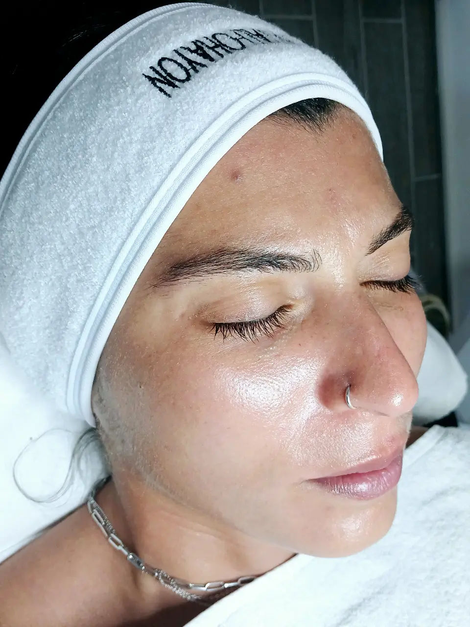 החדרת לחות באלקטרופורציה