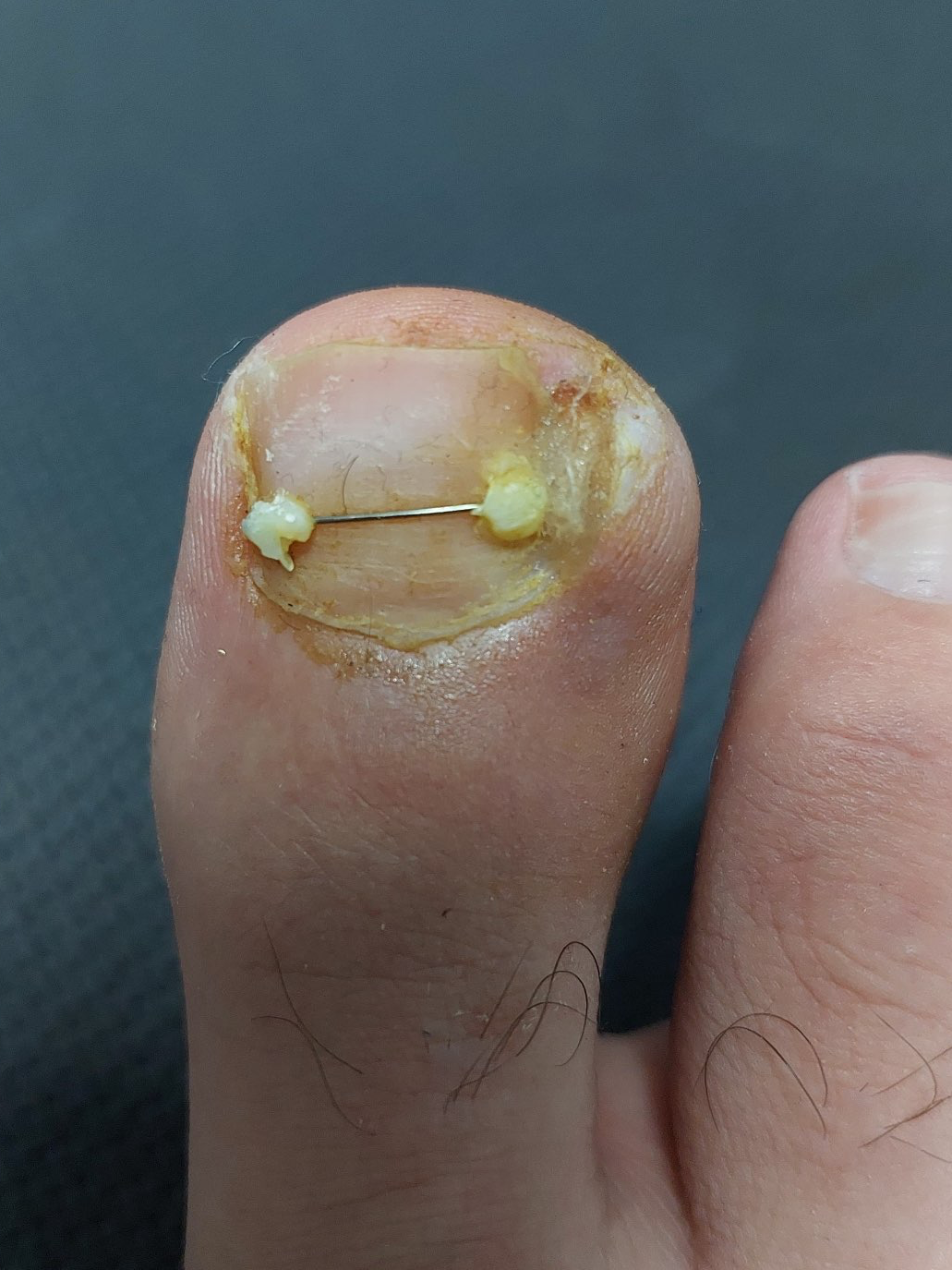 טיפולים שיקומיים ופודולוגים