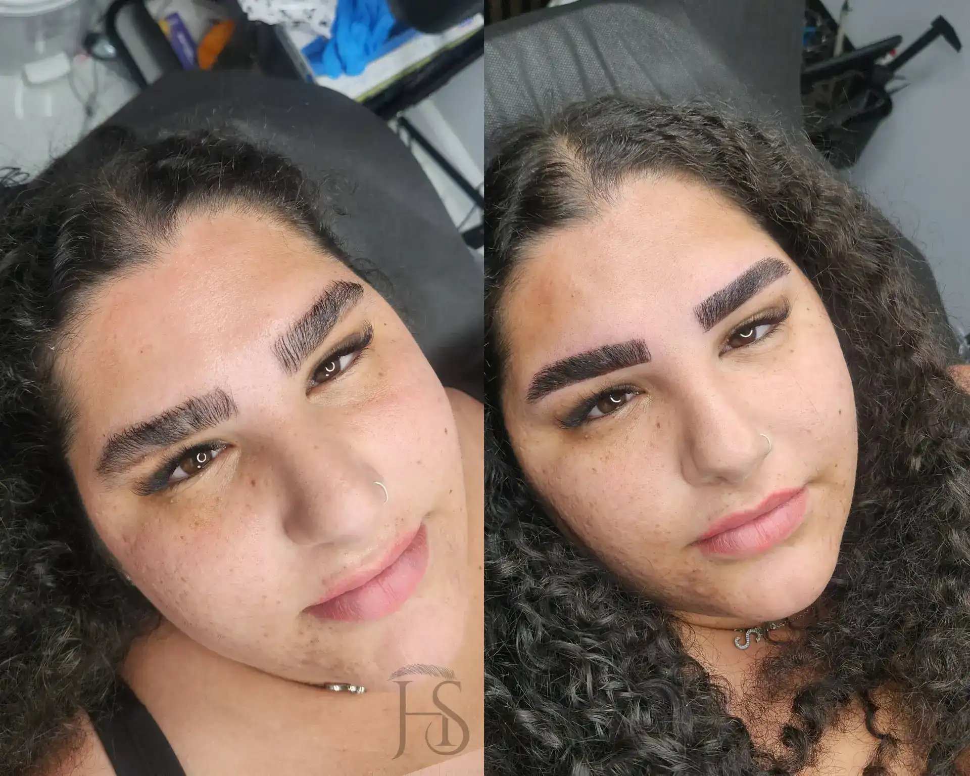 טיפול משולב