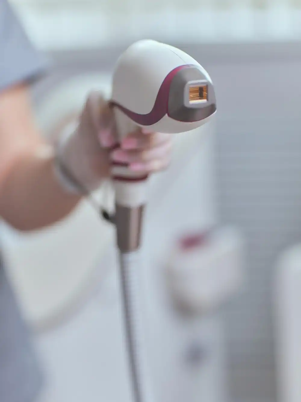 היתרונות של אפילציה לעומת שיטות אחרות להסרת שיער