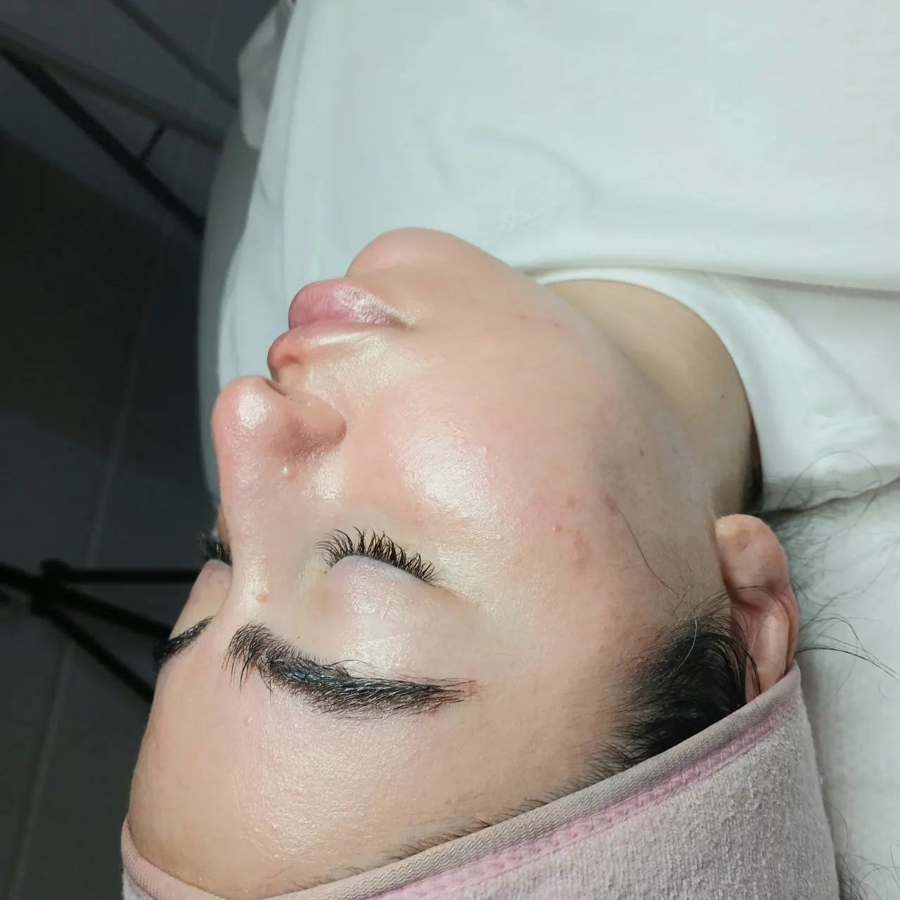 טיפול פנים קלאסי