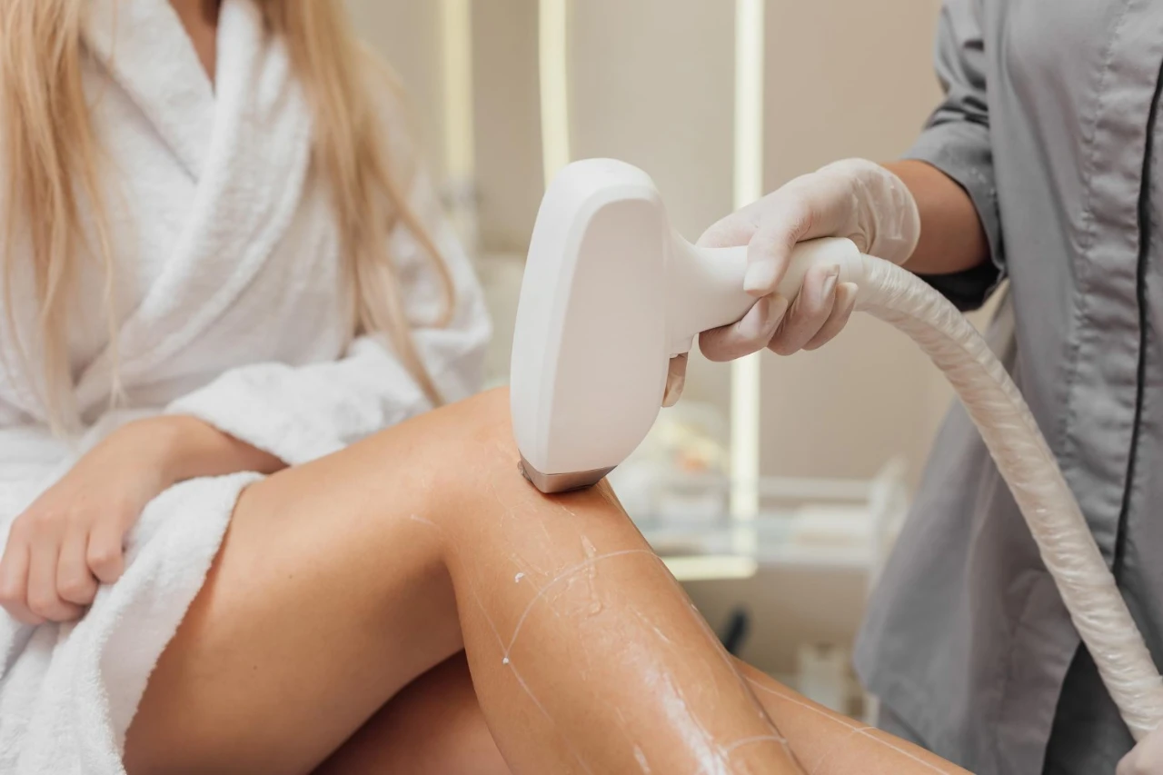 הסרת שיער בלייזר – שאלות ותשובות