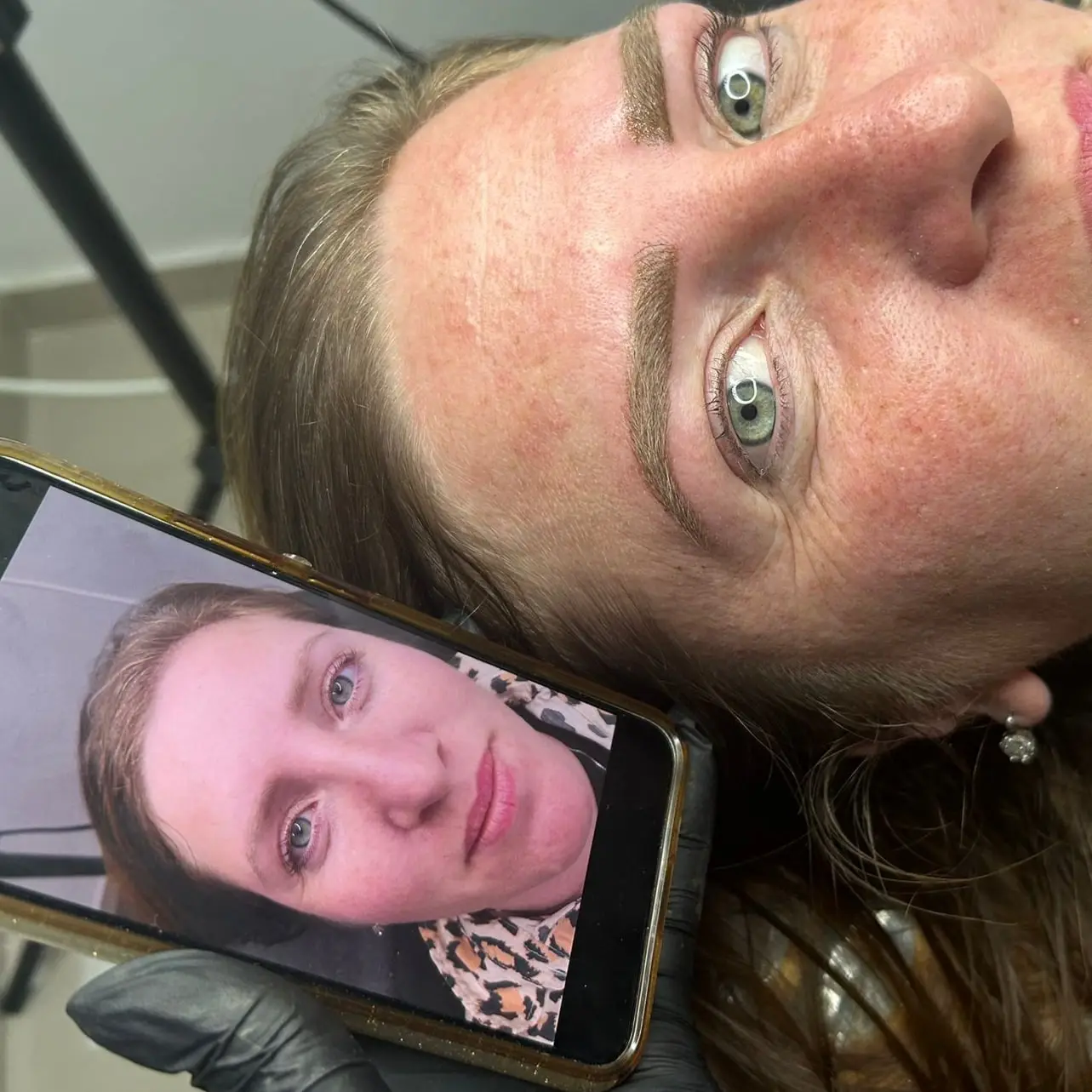 טיפול משולב