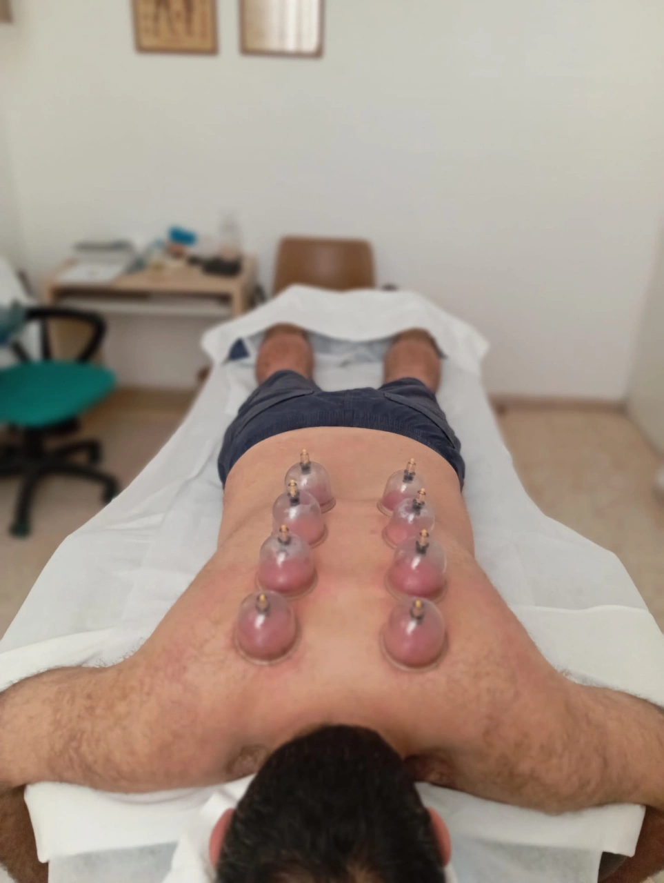 כוסות רוח – 30 דקות