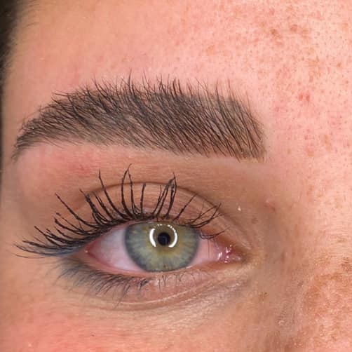 מיקרובליידינג