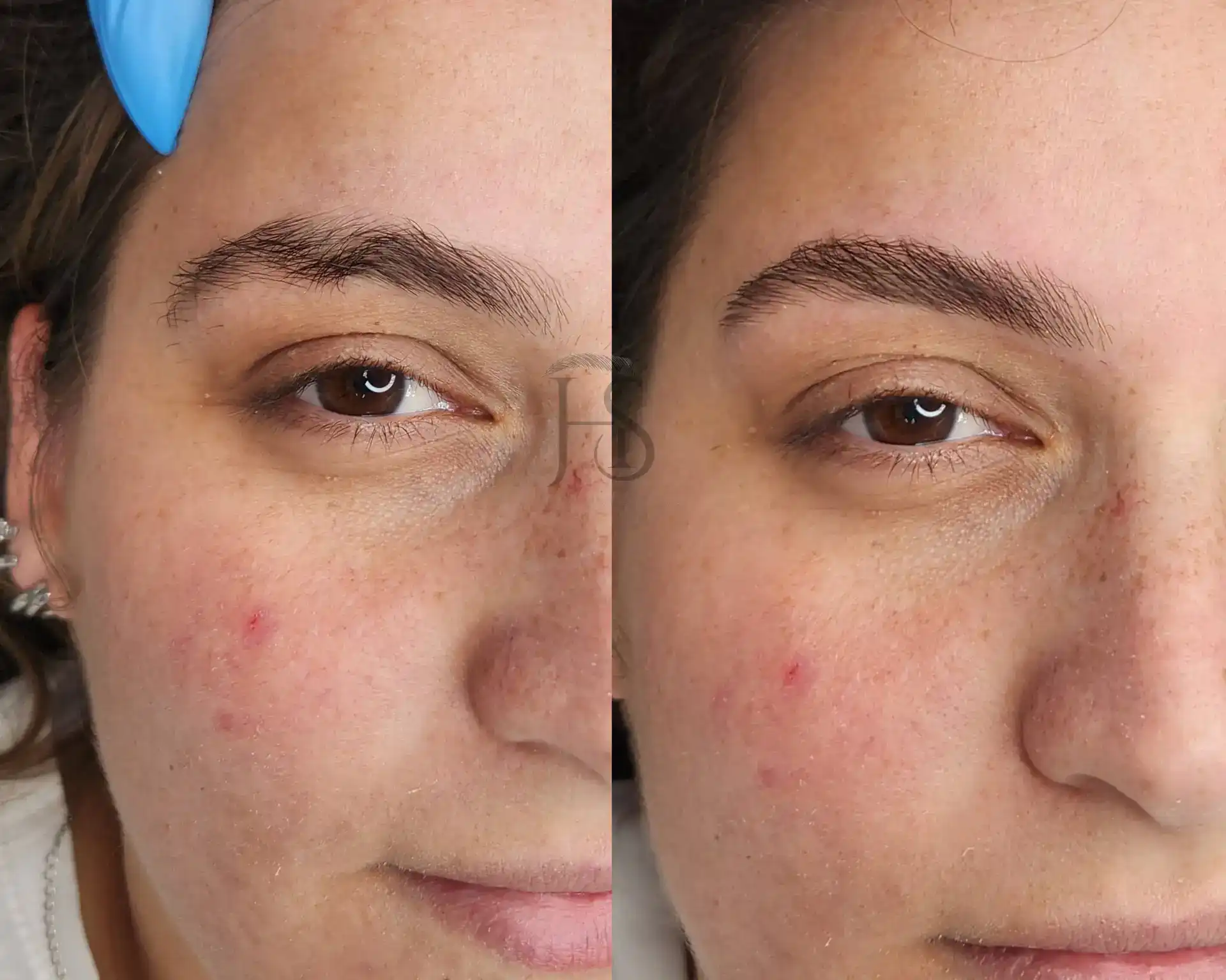 עיצוב ושיקום הגבות