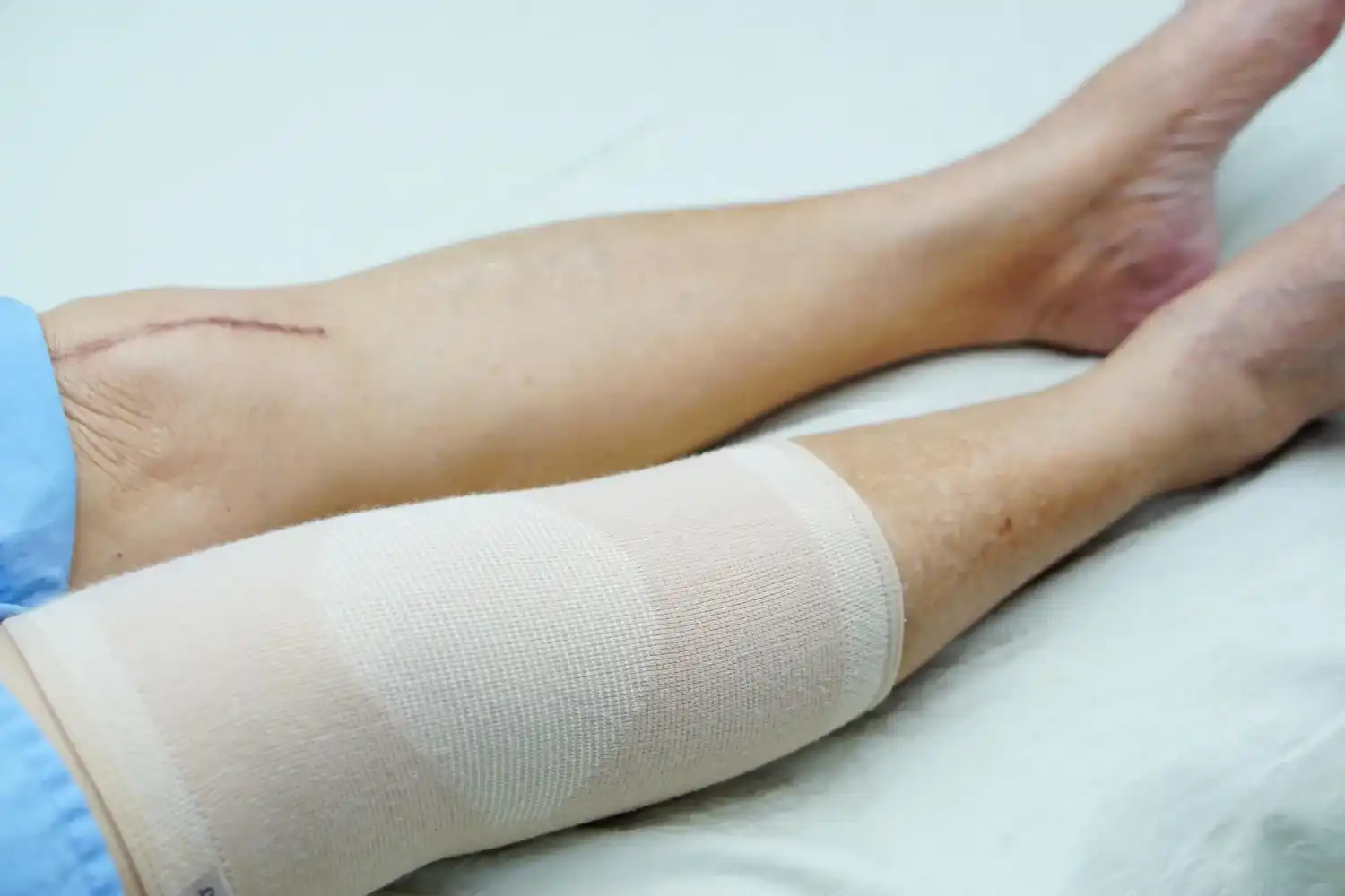 טיפול בפצעים קשיי ריפוי 