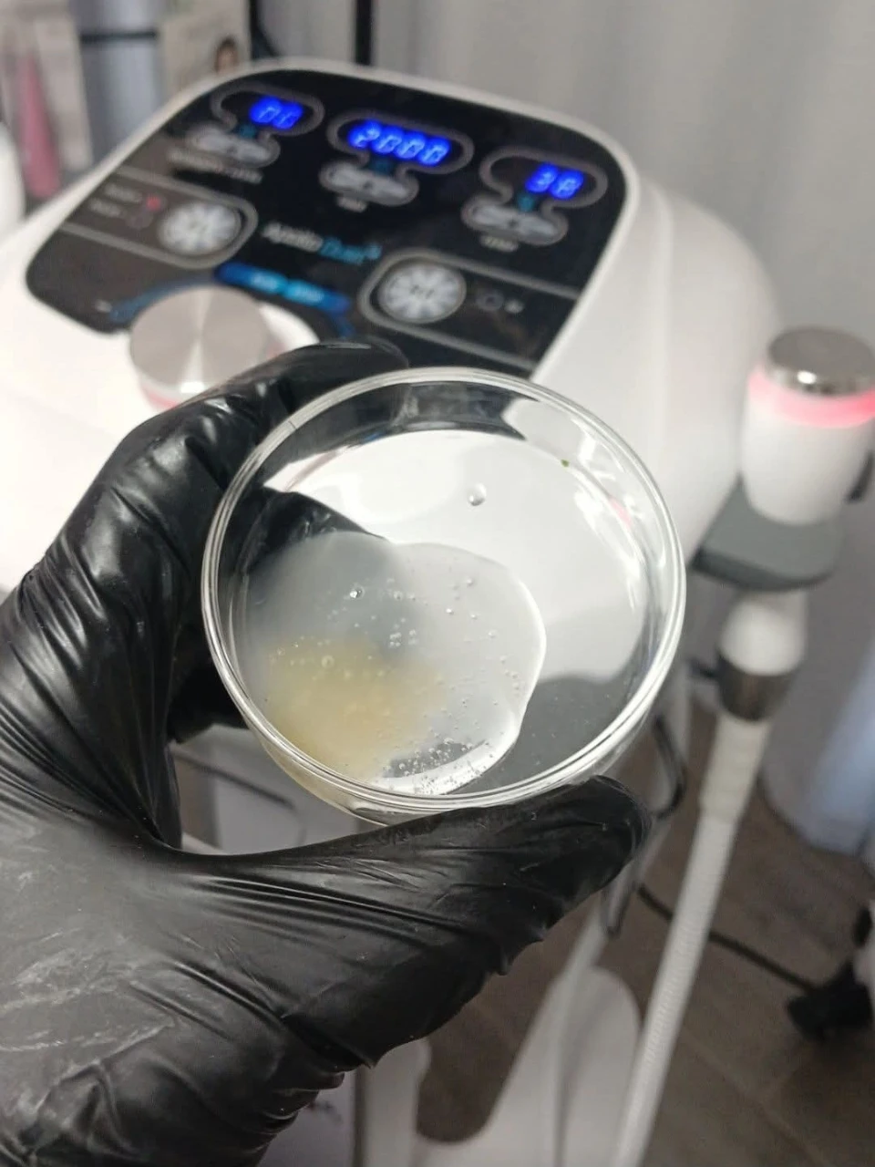 RF למיצוק עור הפנים – מה חשוב לדעת לפני הטיפול