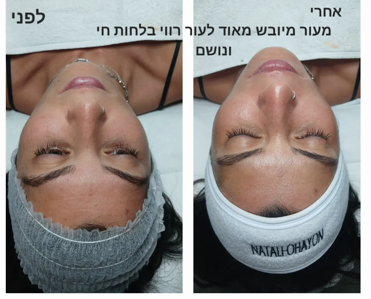 החדרת לחות באלקטרופורציה