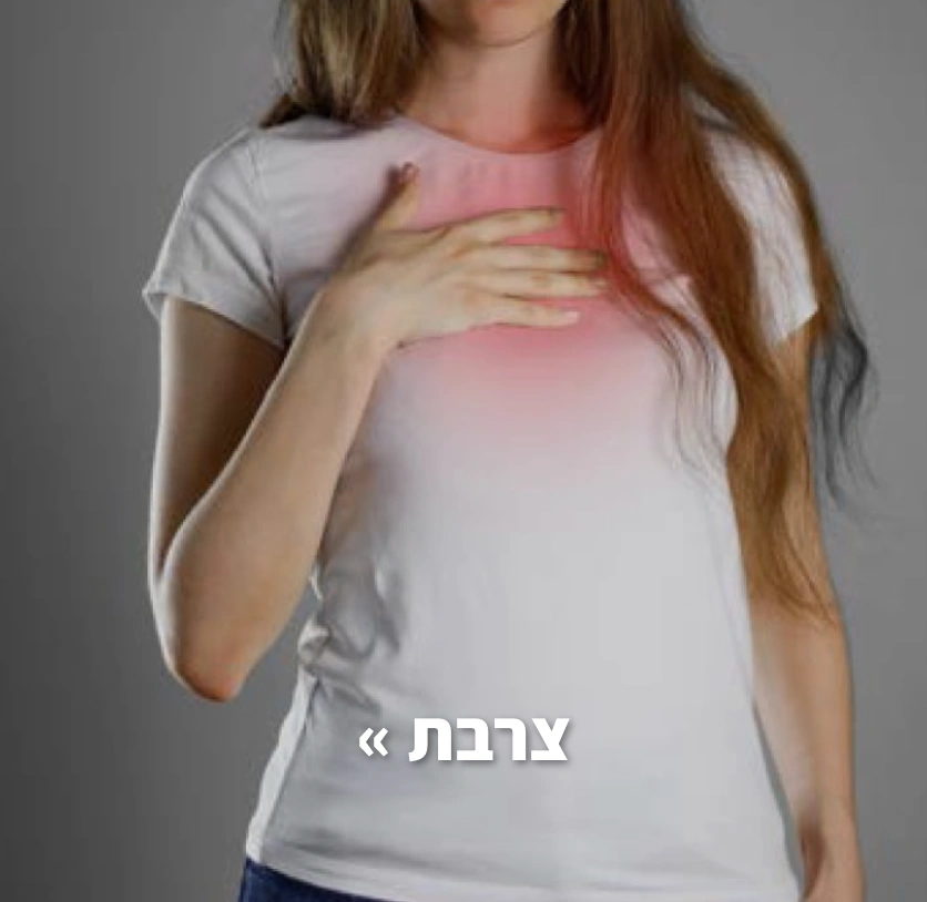צרבת