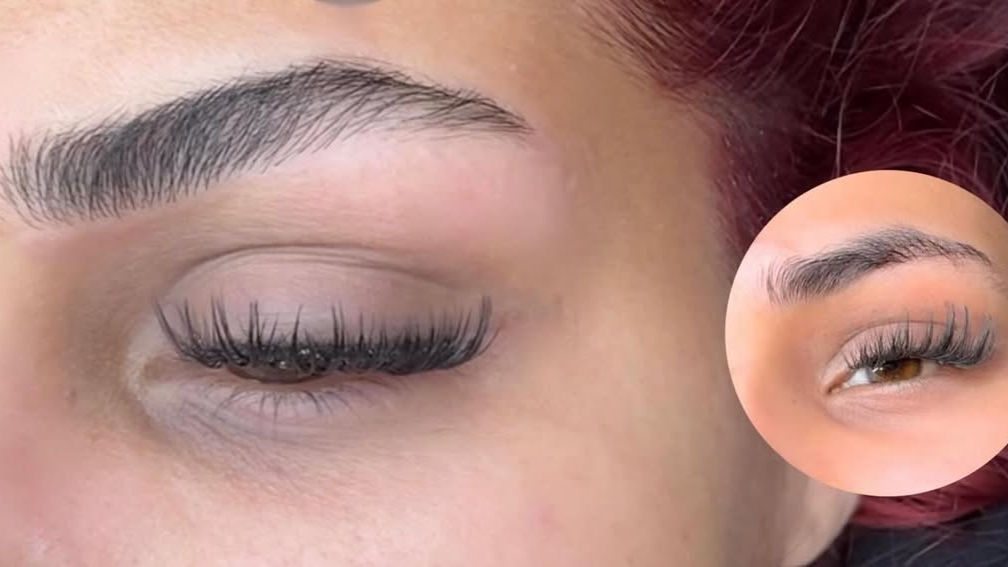 מיקרובליידינג (שיטת השערה)