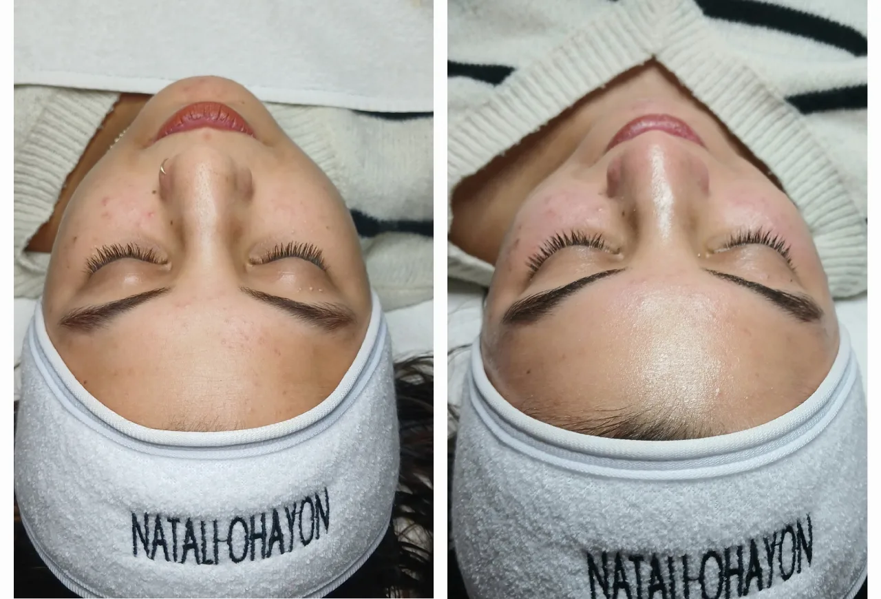  טיפול איזון ויופי לכלה