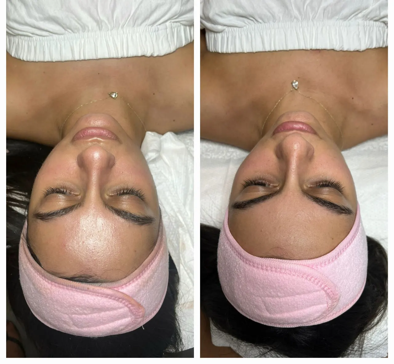 טיפול פנים קלאסי