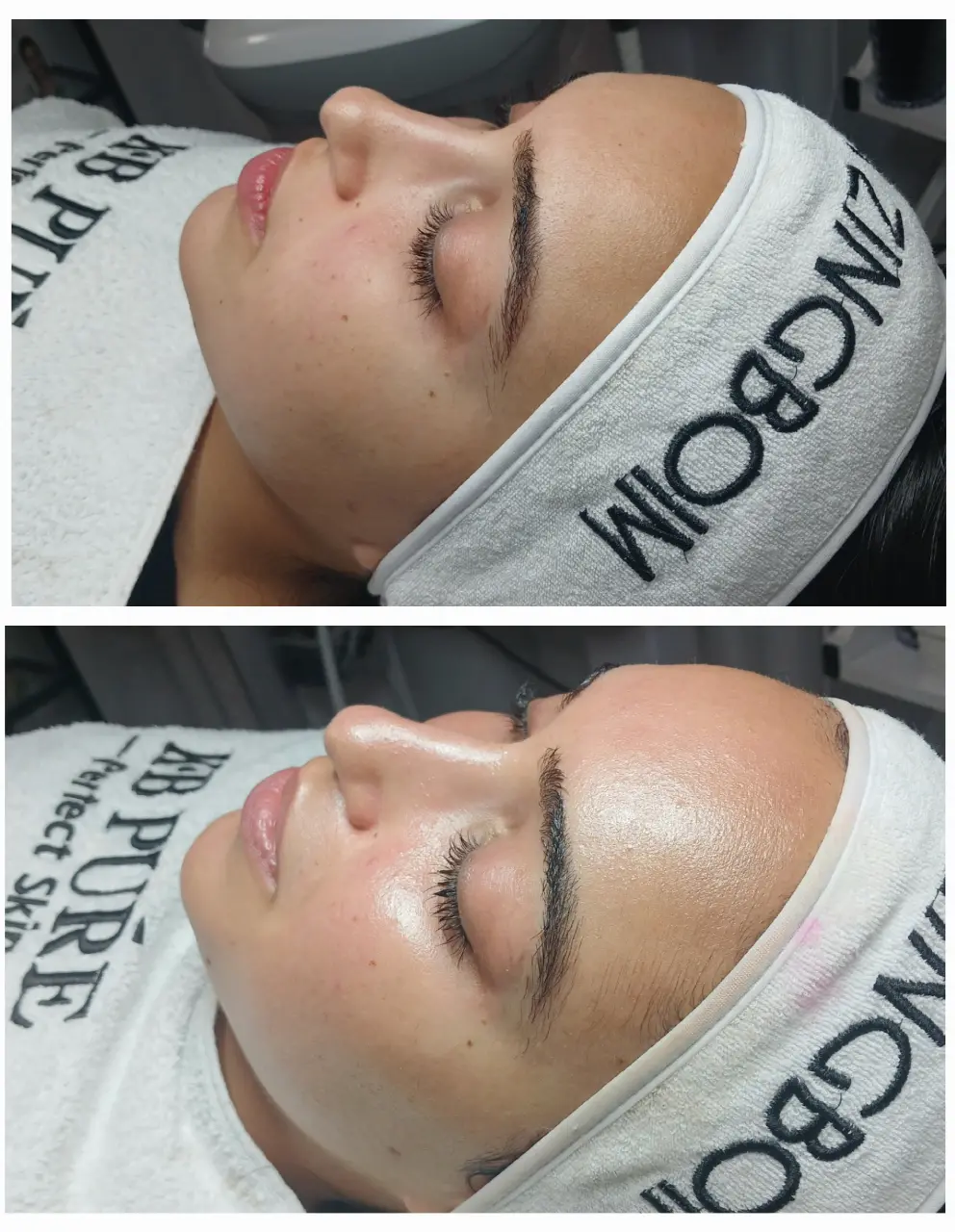 טיפול פנים קלאסי