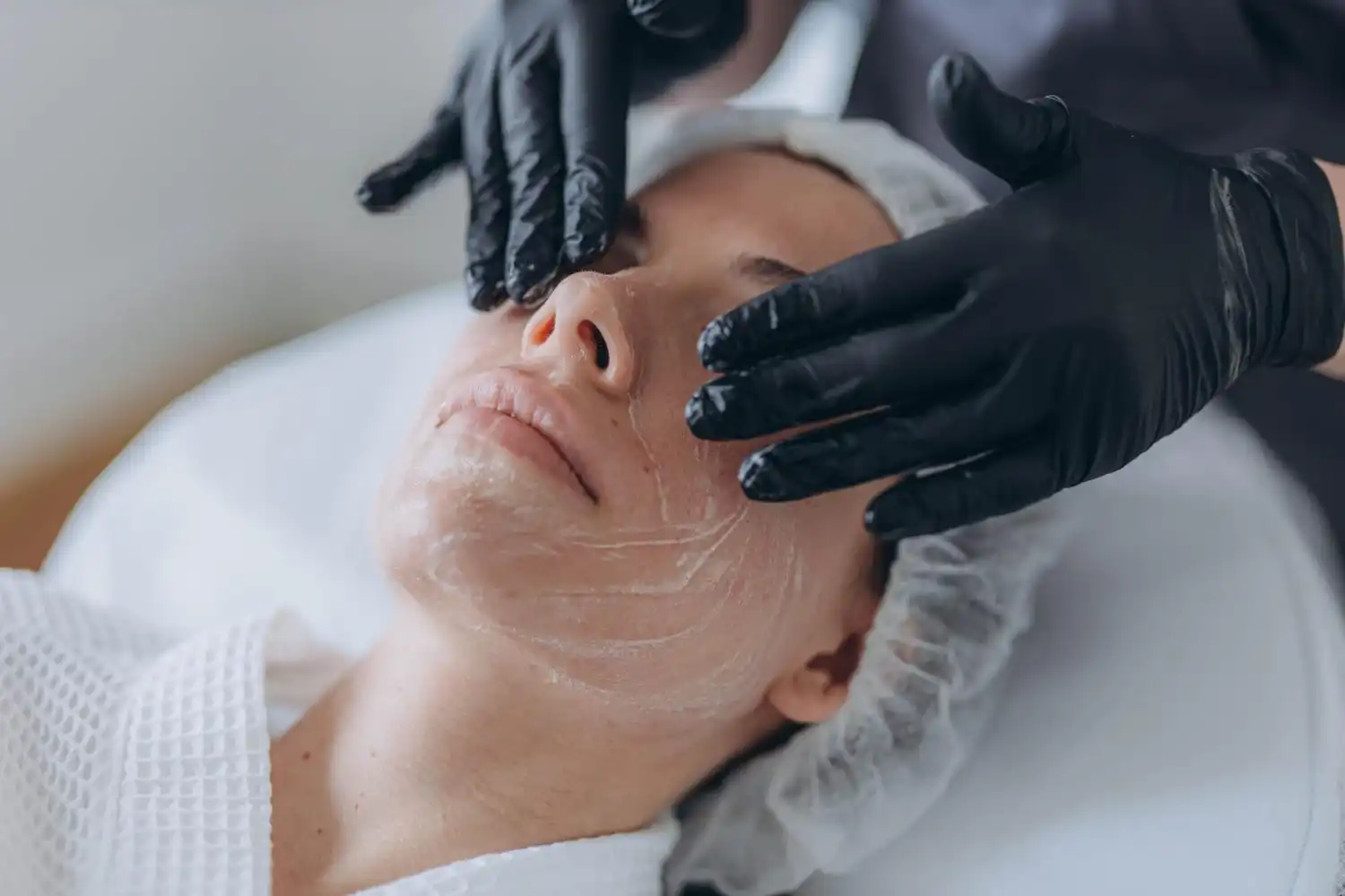 פלזמה – קמטים עמוקים, הרמת עפעפיים ופיגמנטציה