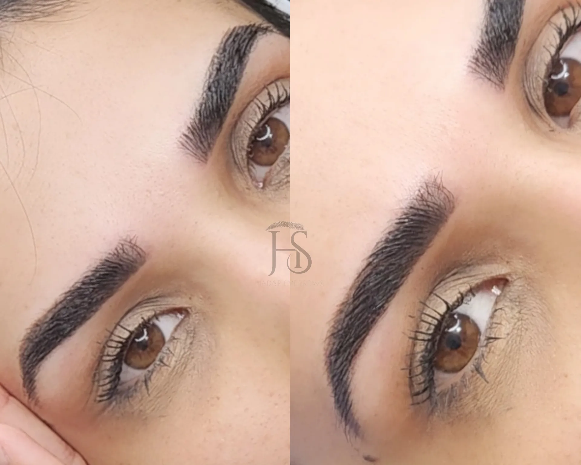 איך לבחור את הטיפול הנכון לעיצוב ושיקום גבות