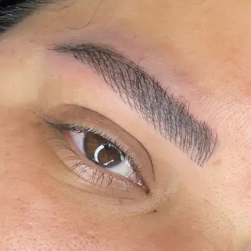 מיקרובליידינג