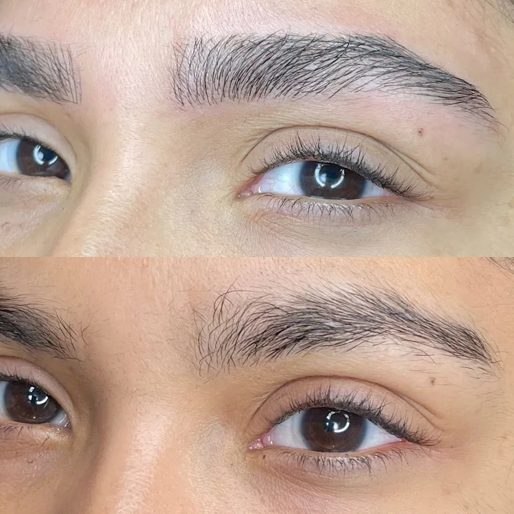 טיפול מיקרובליידינג| מיקרושיידינג