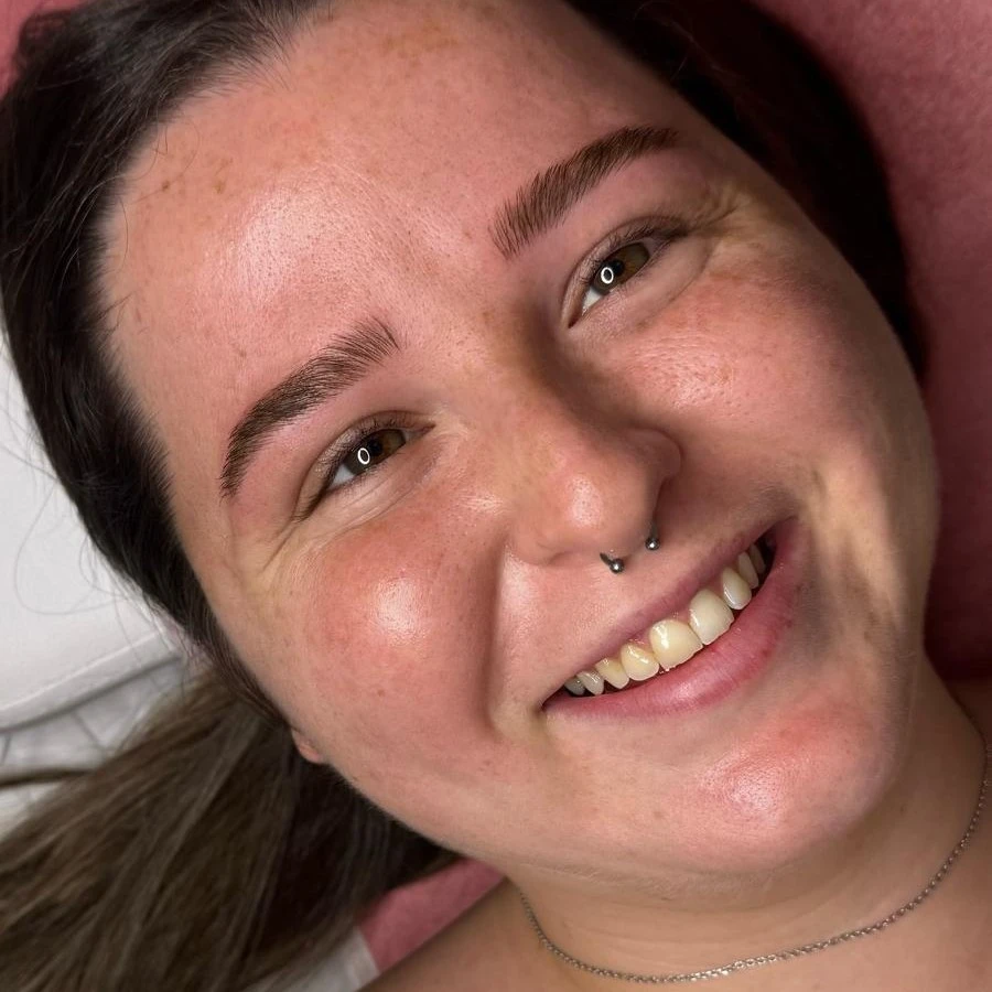 מיקרובליידינג