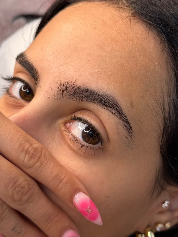 לפני - אחריי 🪄