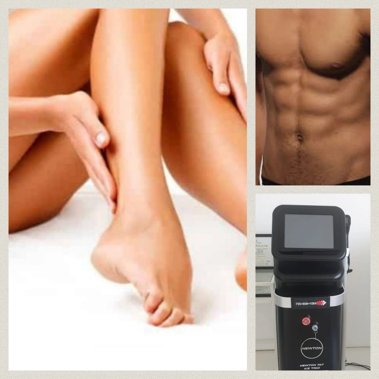 מכשור הלייזר שלנו - הסרת שיער לצמיתות!