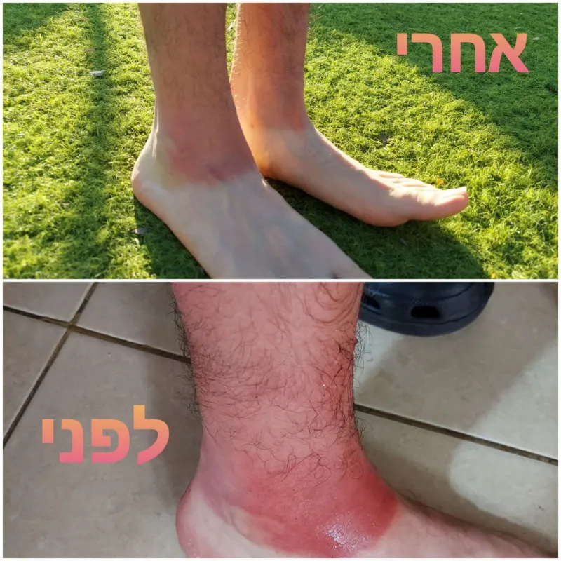 אלוורה ג'ל