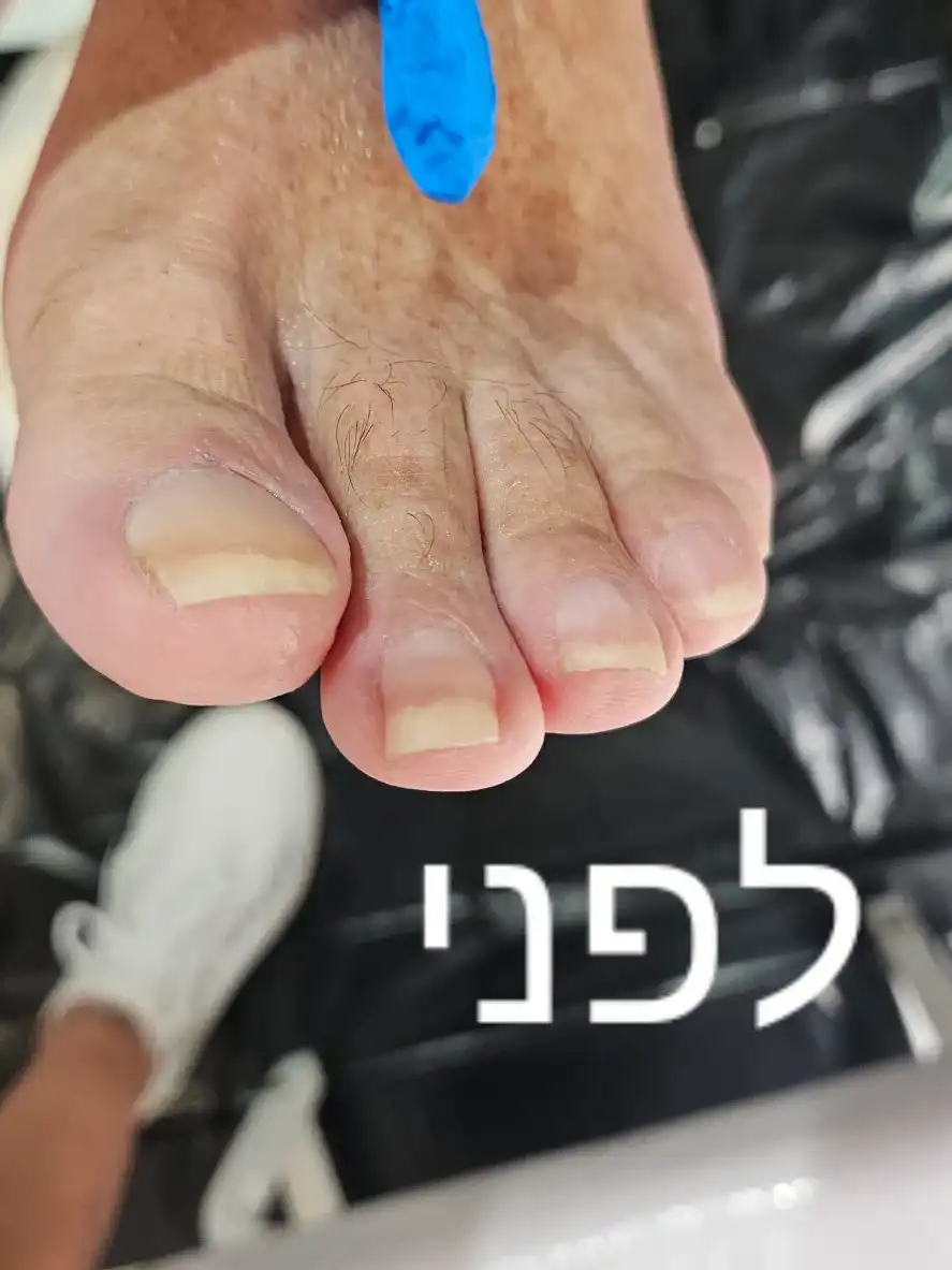 פדיקור רגיל